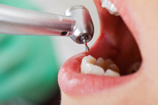 Best Urgent Dental Care  in Shawnee Hills, OH